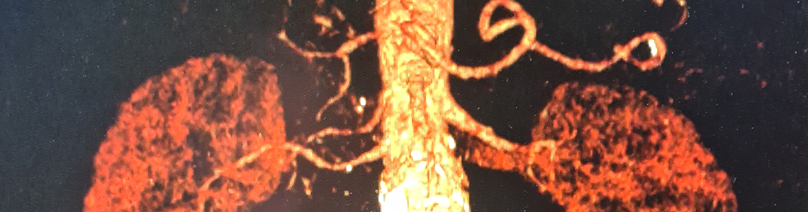 Computertomographie Aufnahme